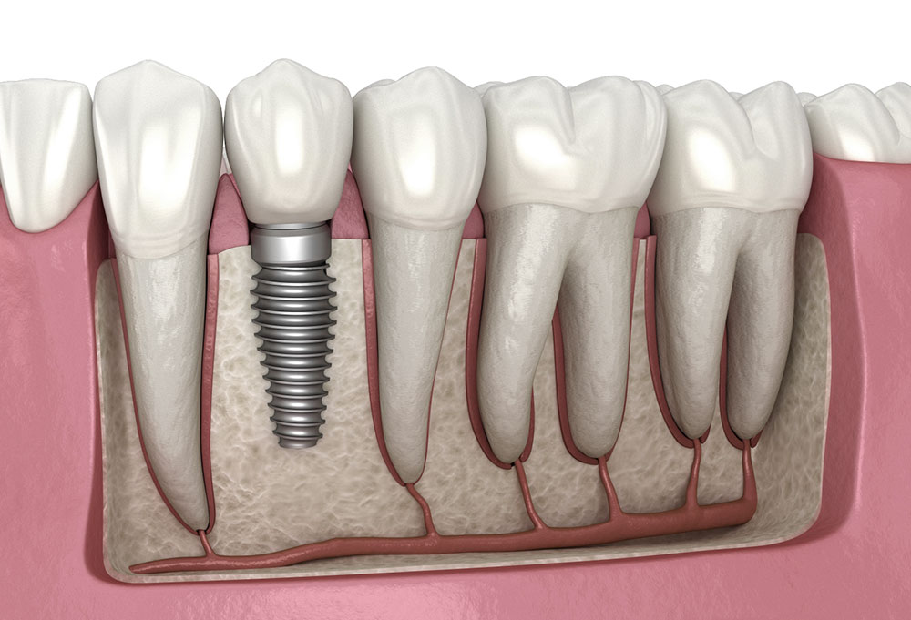 Fair Dent - Specialist Dental Studio & Root Canal Hub